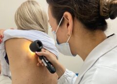 Cepon alerta sobre prevenção e diagnóstico do melanoma, câncer de pele mais grave